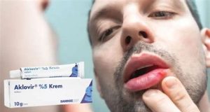 Aklovir krem ne işe yarar – ne için kullanılır? Aklovir krem ne işe yarar - ne için kullanılır?
