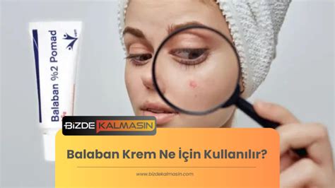 Balaban krem ne işe yarar? Balaban krem ne işe yarar?
