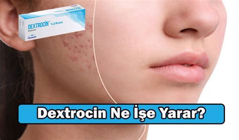 Dextrocin krem ne işe yarar Dextrocin krem ne işe yarar